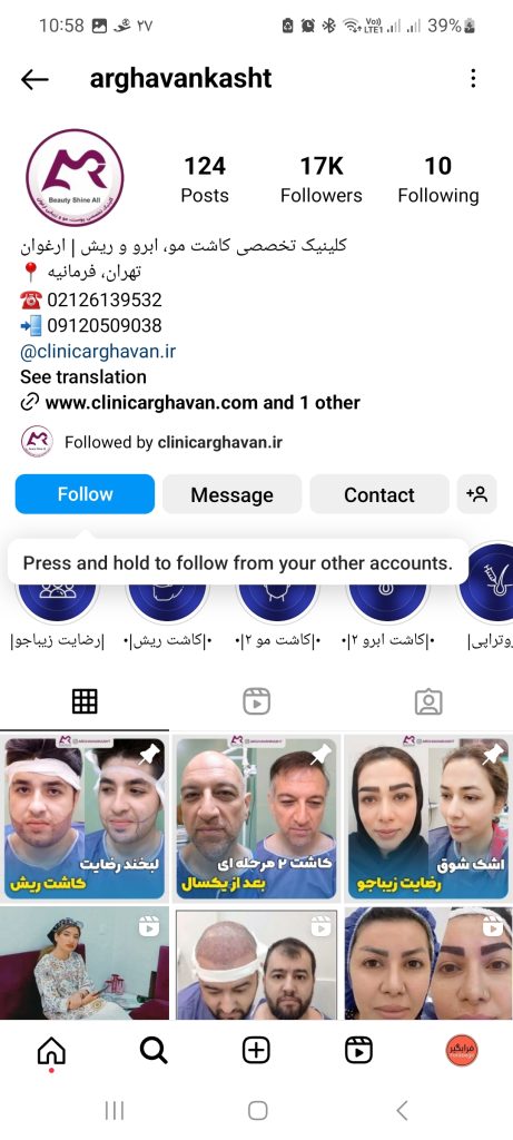 کلینیک کاشت مو ارغوان 461x1024