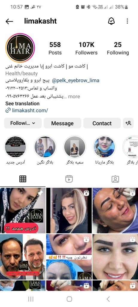 کلینیک کاشت مو لیماکاشت 461x1024